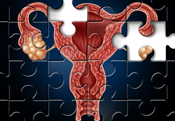 menopause and memory loss