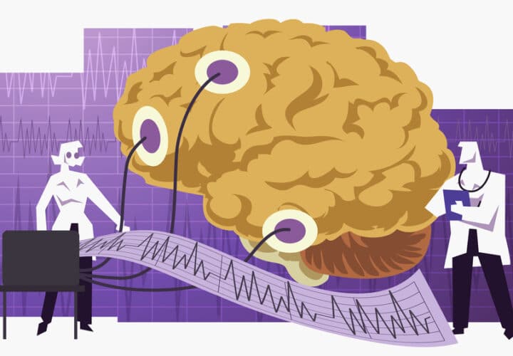 brain implant