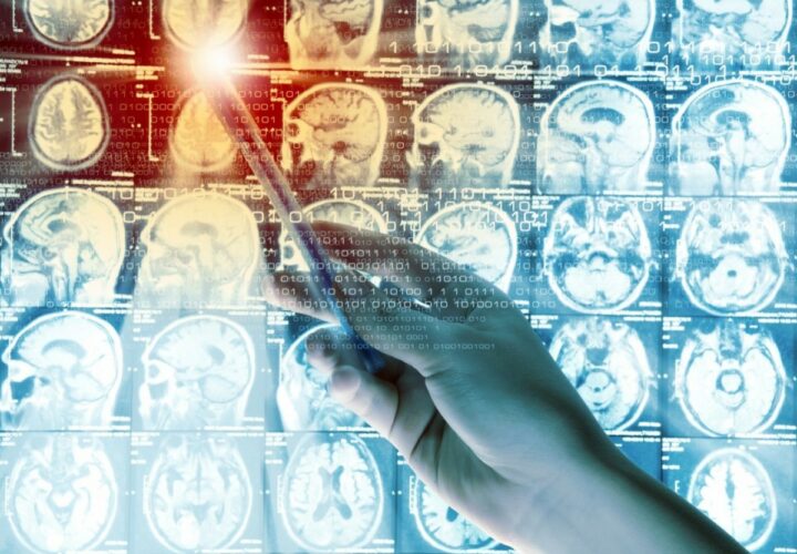 global dementia observatory