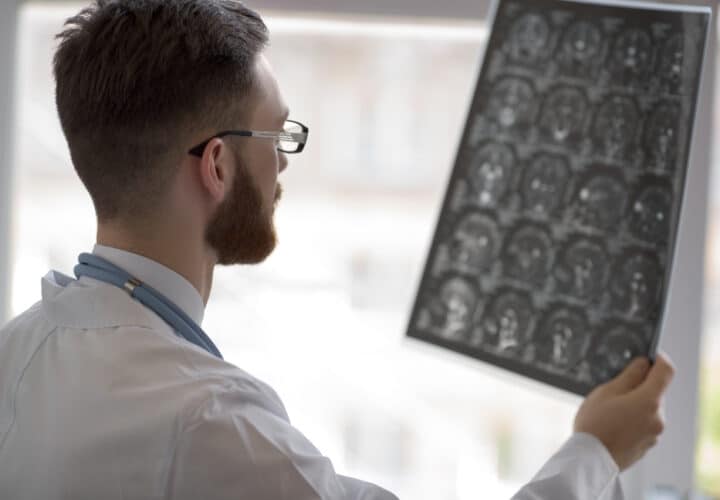 Doctor holding brain mri