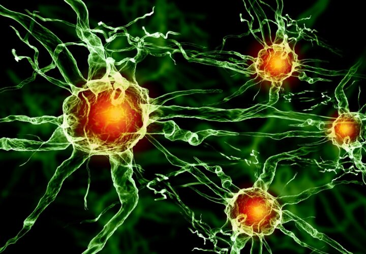 drugs organ transplant alzheimers