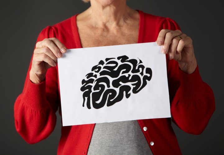 what is the definition of alzheimer's