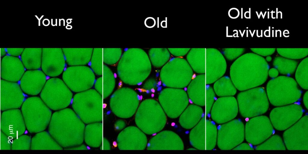 hiv-drug-for-alzheimers