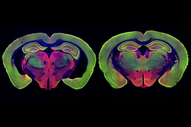 brain scans of mice treated with gamma light therapy