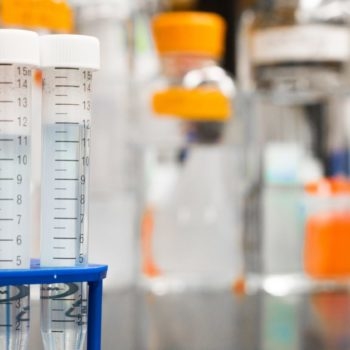 Alzheimer's blood test