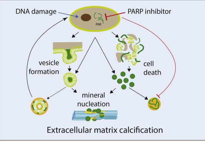 process by which arteries calcify