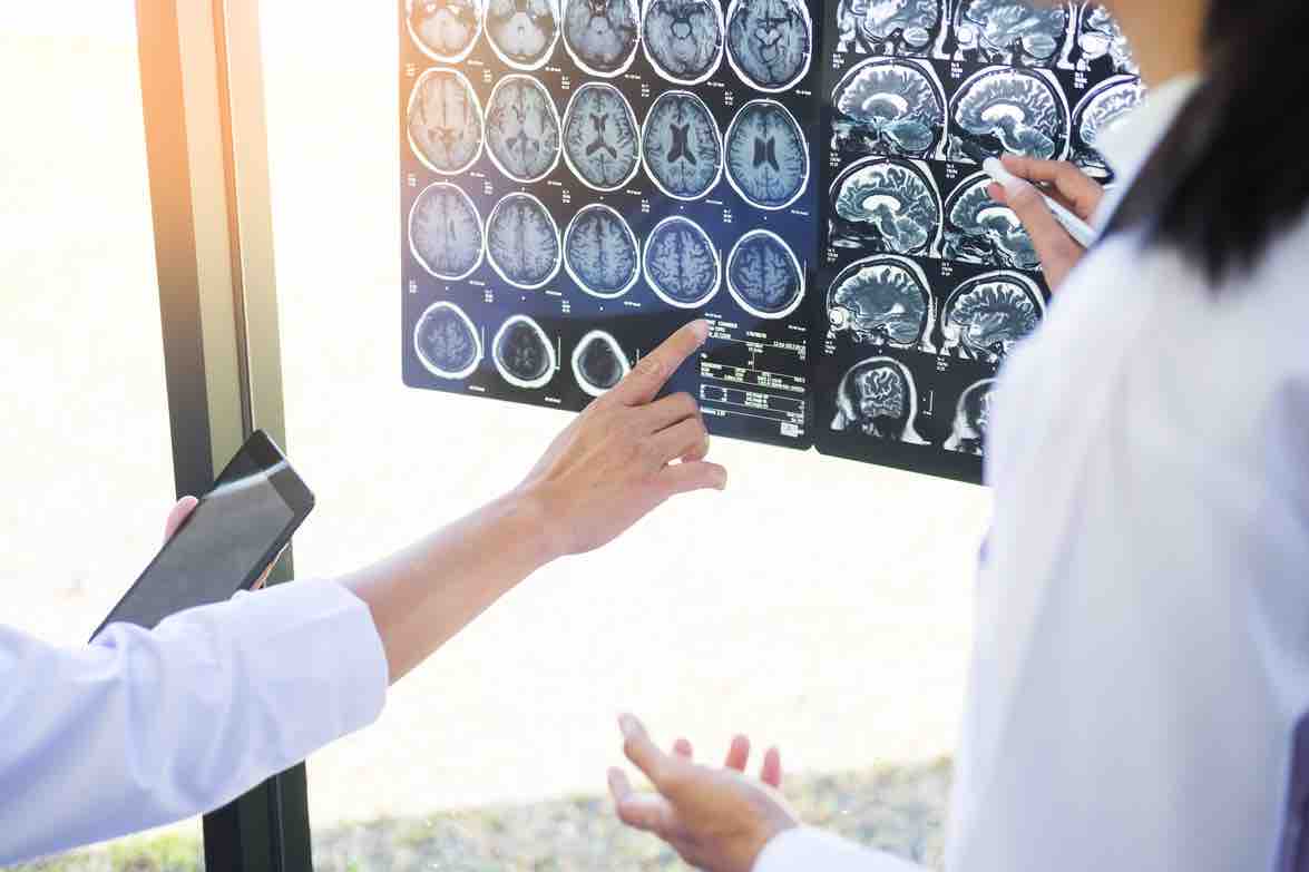 Two doctors analyzing a scan or x-ray film or explains a CT scan together with serious thoughtful expressions method with patient treatment results on brain to an anomaly on the film