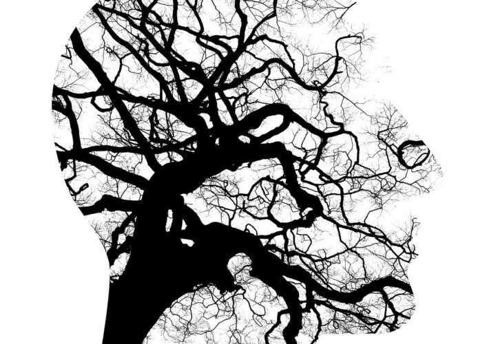 Brain