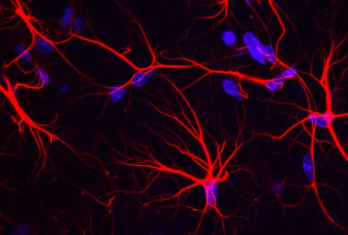 Alzheimer's metabolism