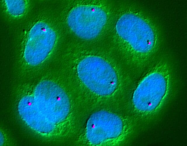 Ube2h gene