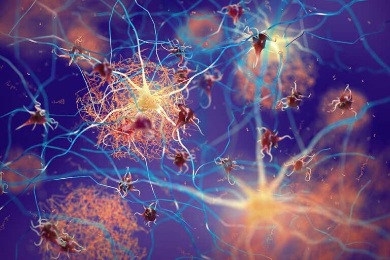 alzheimers crispr, rudy tanzi, genetic variants alzheimer's